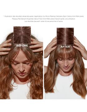 K&eacute;rastase Symbiose Bain Cr&egrave;me Anti-Pelliculaire Shampoo 250 ml