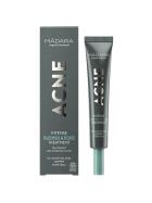Madara Acne Intense Blemish & Pore Treatment 20 ml