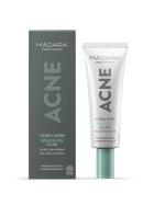 Madara Acne Hydra-Derm Balancing Fluid 40 ml