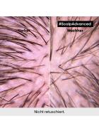 LOr&eacute;al Professionnel Scalp Advanced Anti-Discomfort Intense Soother Treatment 200 ml