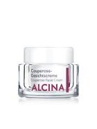 Alcina Couperose-Gesichtscreme 50 ml