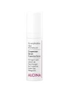 Alcina Couperose-Serum 30 ml